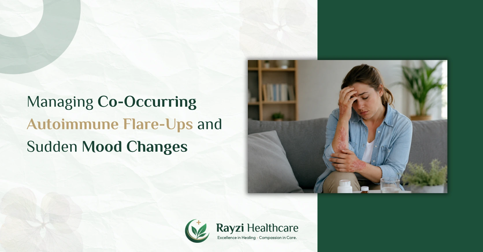 Managing Co Occurring Autoimmune Flare Ups and Sudden Mood Changes